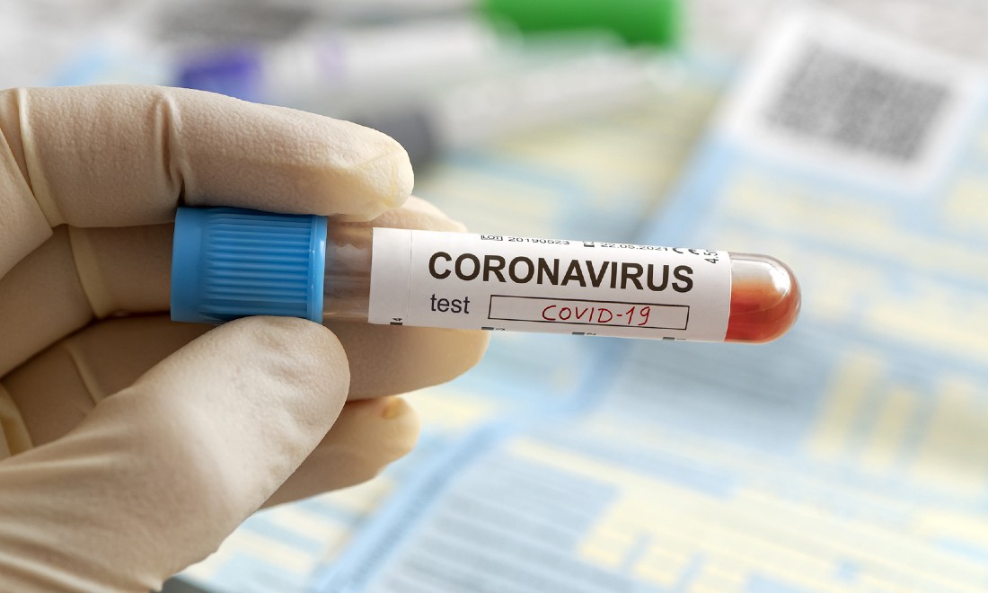 Coronavirus update (March 24): Death toll at 276